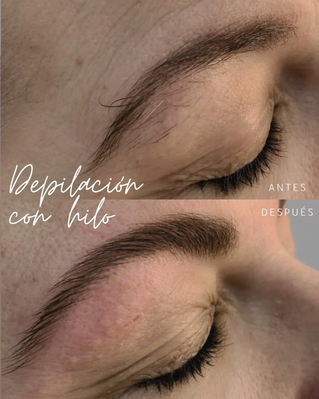 Depilación facial con hilo antes y después, Rosalía Salón Vila-real
